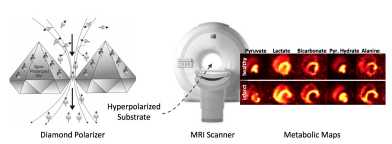 MetaboliQs