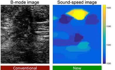 echography