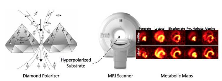 Enlarged view: Diamond-based Hyperpolarized MRI