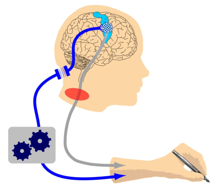 Enlarged view: Brain-machine interface